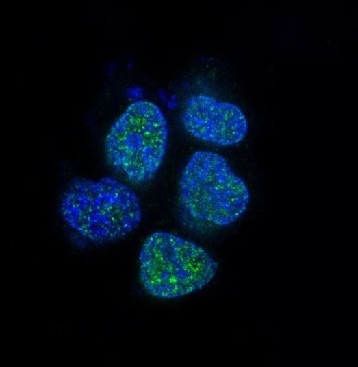 Androgen receptor Ab - 上海埃必威生物技术有限公司