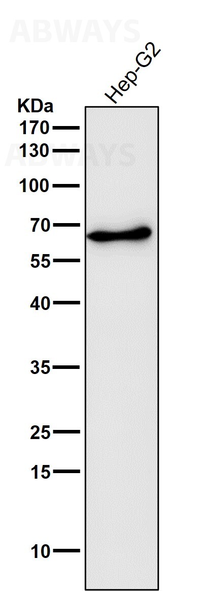 catalase 基本信息 | sino biological Images High... Catalase Ab - 上海埃必威生物技术有限公司
